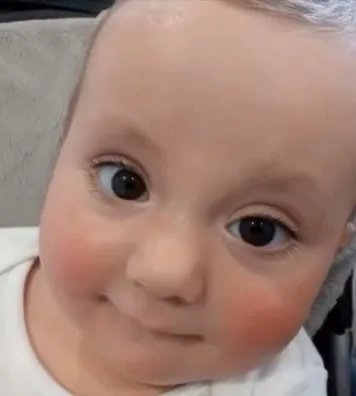 Primer plano de Peio con sus grandes ojos